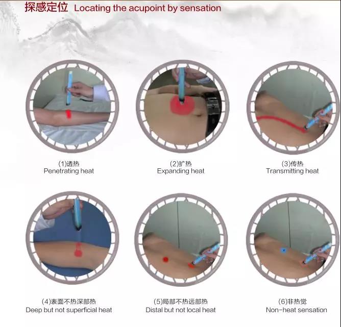 熱敏灸
