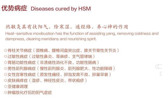 熱敏灸