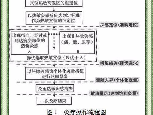 【轉載】重視熱敏灸感是提高灸療療效的關鍵